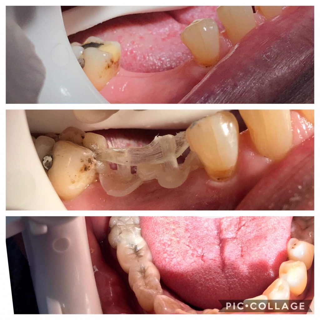 K Sud Dental Clinic - British Dentist Moraira
