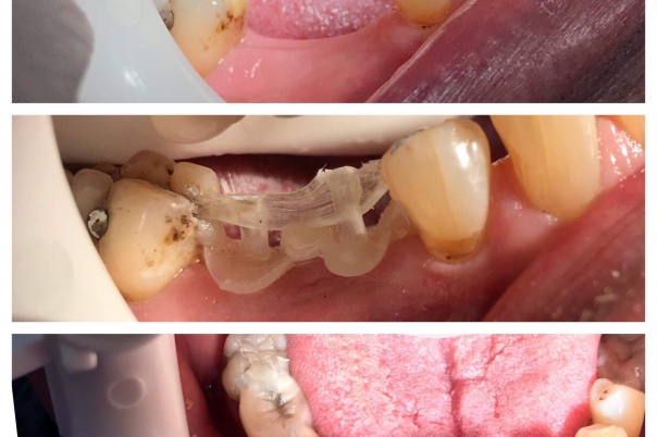 K Sud Dental Clinic - British Dentist Moraira