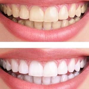 Clinica Dental la Plaza - Dentist & Beauty Clinic Javea