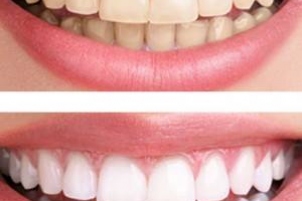 Clinica Dental la Plaza - Dentist & Beauty Clinic Javea