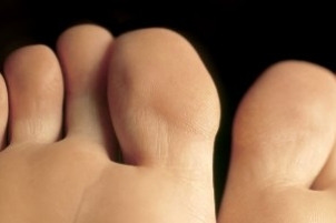 Calpe Podólogos - Clinica Portalet - Podiatry Clinic Calpe