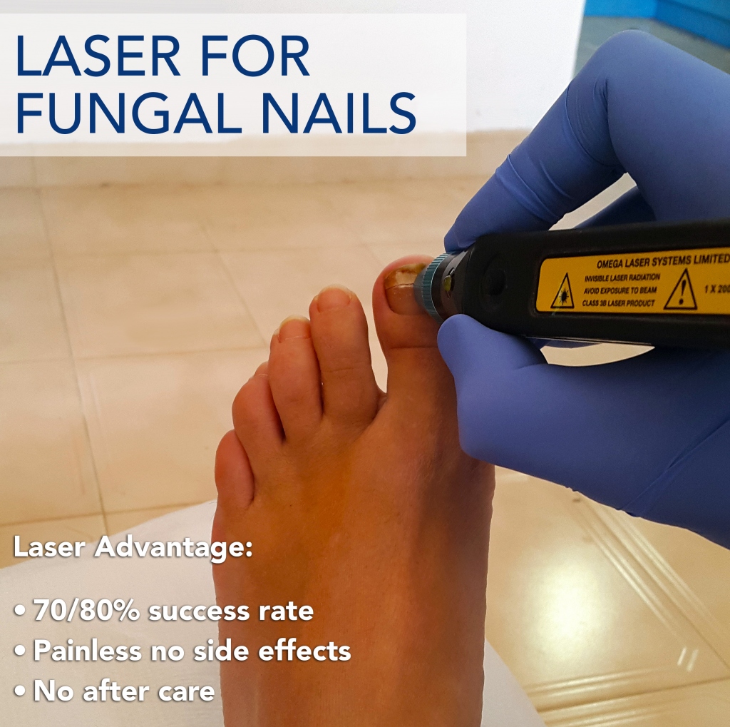 Foot Podiatrist Costa Blanca