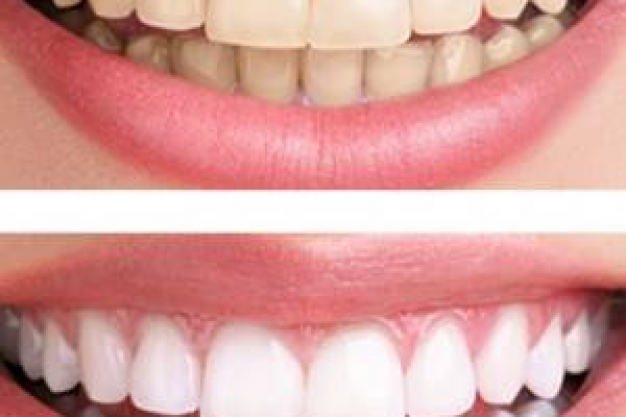 Advice on Simple Ways to Improve Your Smile - from Clinica Dental La ...