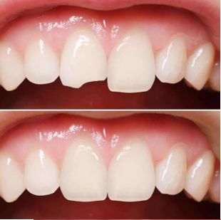 Advice on Simple Ways to Improve Your Smile - from Clinica Dental La Plaza