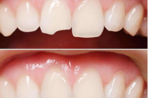 Advice on Simple Ways to Improve Your Smile - from Clinica Dental La Plaza
