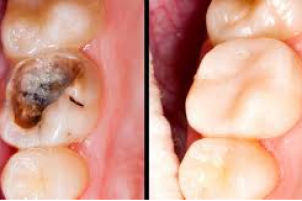 Advice on Simple Ways to Improve Your Smile - from Clinica Dental La Plaza