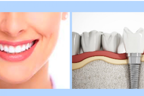OdontoSmile - Calpe Dentist