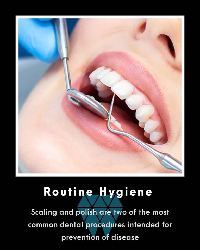 Accu Dental Javea - Dentist & Dental Clinic