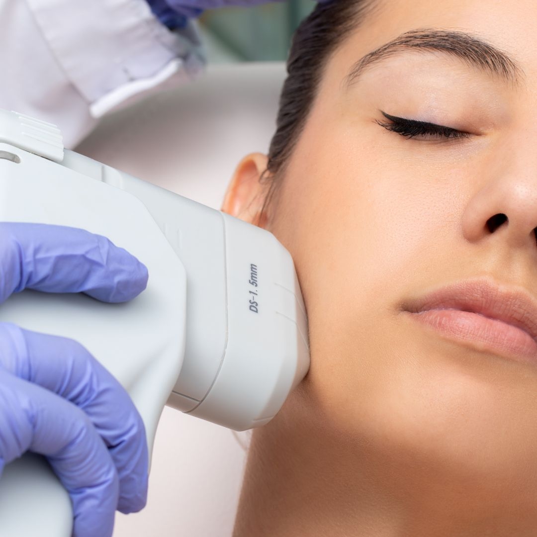HIFU Non-Surgical Facelift at Clinica Miramar