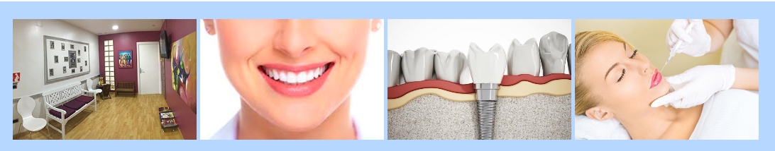 OdontoSmile - Calpe Dentist
